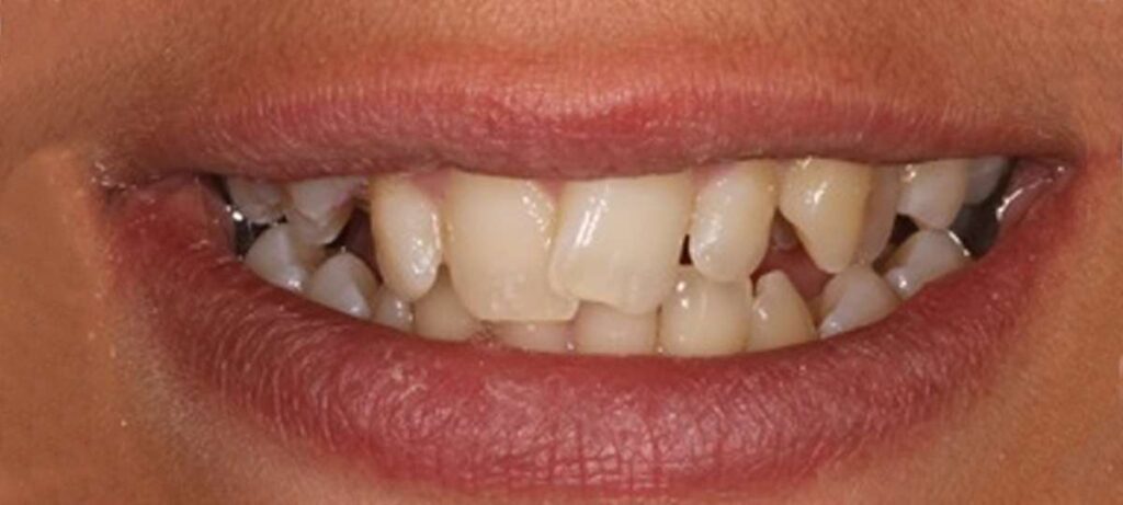 COSMETIC DENTISTRY 