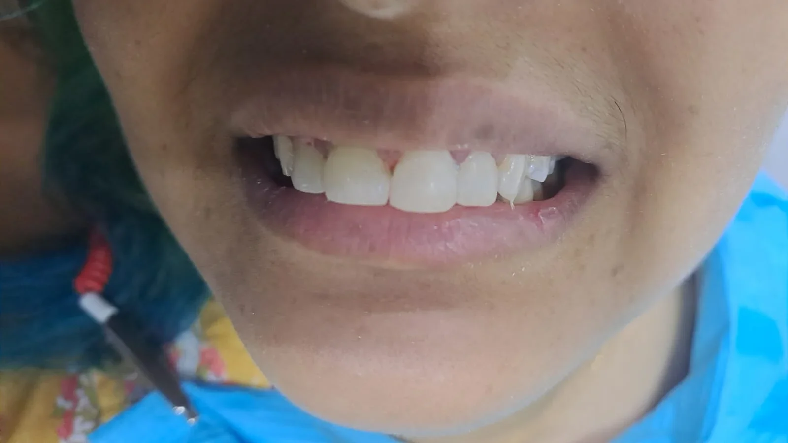 After 4 e1763064022677