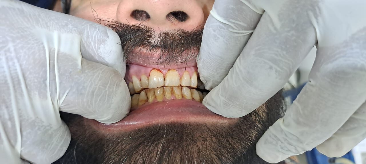 WhatsApp Image 2025 11 13 at 11.17.55 PM e1763058441322