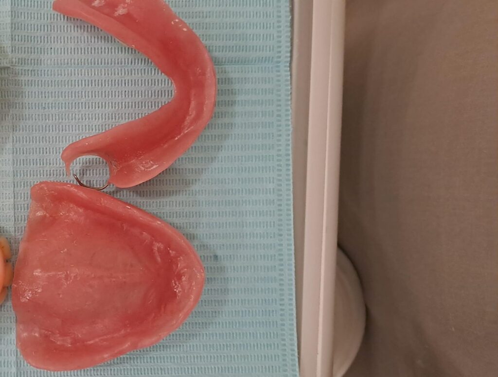 Prosthodontic Denture 3 teeth