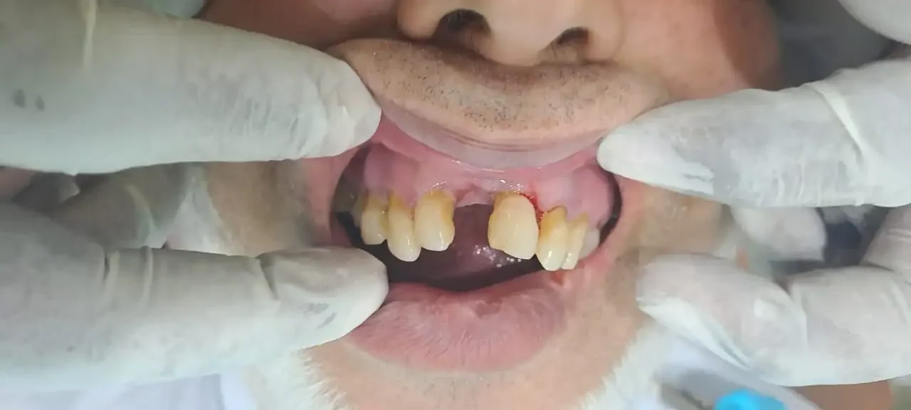Dental case 2